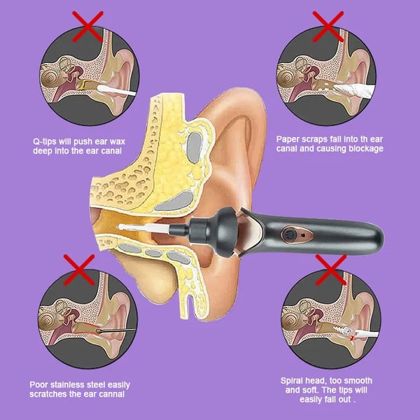 EarClear | Painless Ear Wax Removal Kit for Safe & Effective Cleaning for Adults & Kids
