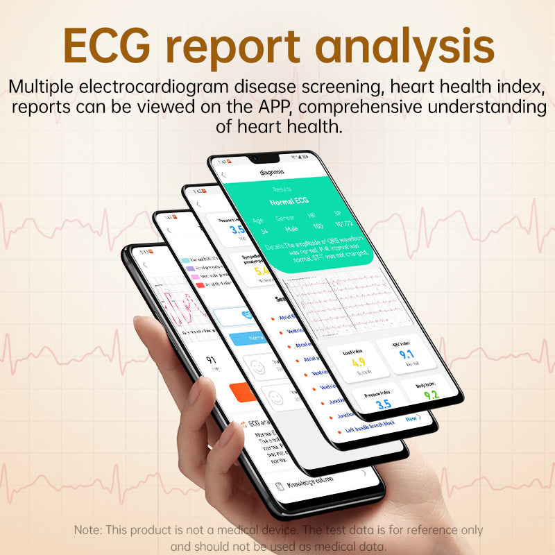 KP300 High-Precision Airbag Blood Pressure Smart Watch ECG Heart Rate Blood Sugar Uric Acid Blood Lipids Blood Oxygen Sleep